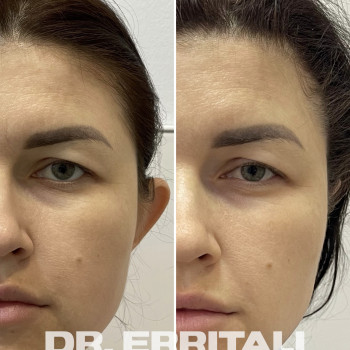 Абдель Эрритали, Харків Фото - 83