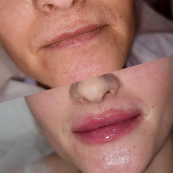 Ирина Булгар, Одесса Фото - 55