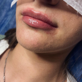 Катерина Якимович, Ивано-Франковск Фото - 8