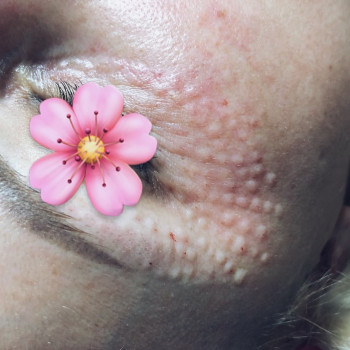 Катерина Якимович, Ивано-Франковск Фото - 15