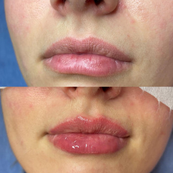 Катерина Якимович, Ивано-Франковск Фото - 4