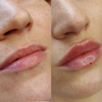 Ирина Булгар, Одесса Фото - 54