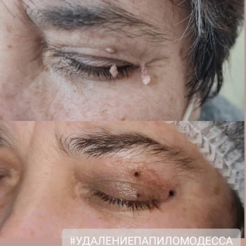 Ирина Булгар, Одесса Фото - 56