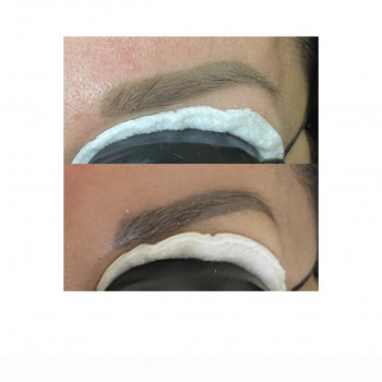 Видалення татуажу
                    Салон красоты Beauty Bar Винница