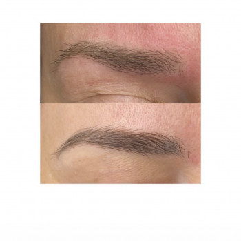 Видалення татуажу
                    Салон красоты Beauty Bar Винница