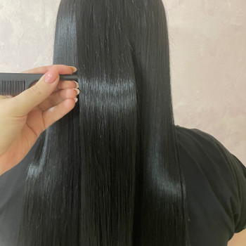 Ботокс, фото - трихолог Оксана С