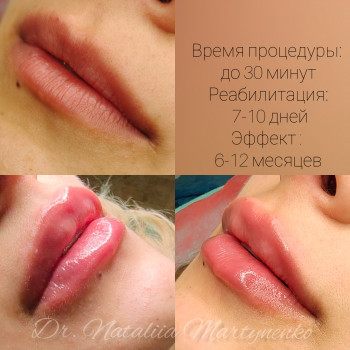 Наталия Мартыненко, Сумы Фото - 47