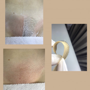 Валентина Кустовська, Біла Церква Фото - 16