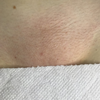 Валентина Кустовська, Біла Церква Фото - 18