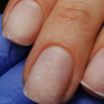 Ольга Трофимова, Чорноморськ Фото - 6