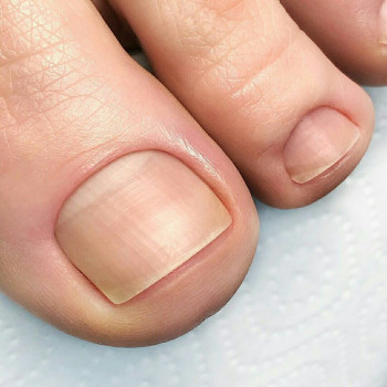 Ольга Трофимова, Чорноморськ Фото - 9