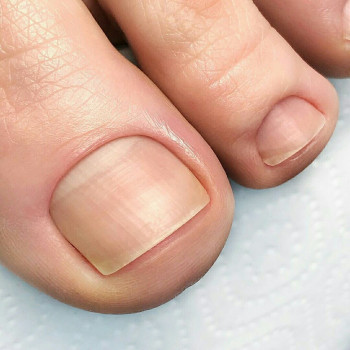 Ольга Трофимова, Чорноморськ Фото - 33