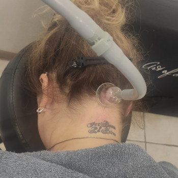 Вакуумний масаж шийно-воротникової зони