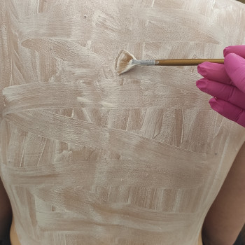 Чистка спини, лікування акне