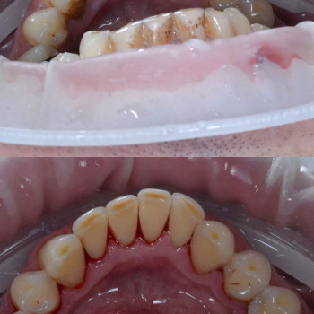 Аліна Степанюк, Рівне Фото - 17