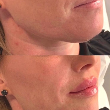 Наталия Нероли, Одеса Фото - 19