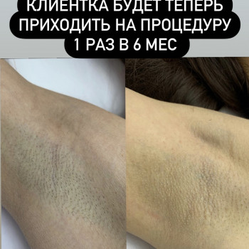 Лина Сидоренко, Запорожье Фото - 5