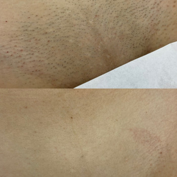 Лина Сидоренко, Запорожье Фото - 9