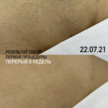 Лина Сидоренко, Запорожье Фото - 10