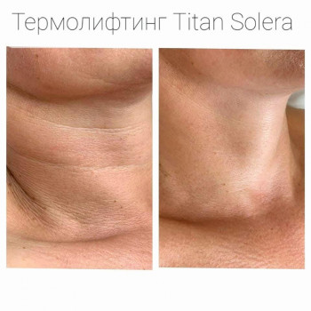 Be Sexy, Винница Фото - 14