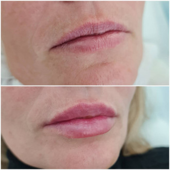 Be Sexy, Винница Фото - 17