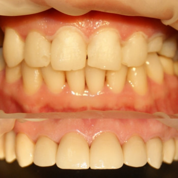 Анастасия Кристодол, Черновцы Фото - 2