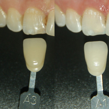 Анастасия Кристодол, Черновцы Фото - 5