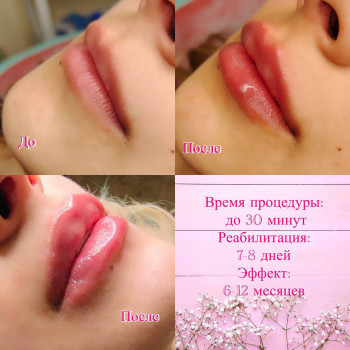 Наталия Мартыненко, Сумы Фото - 50