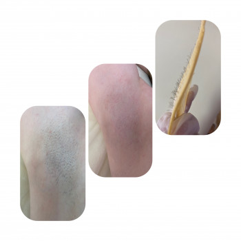 Всього 10хв вашого часу і гладкість шкіри до 3-х тижнів