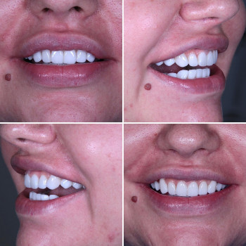 Лолита Литвин, Одеса Фото - 5