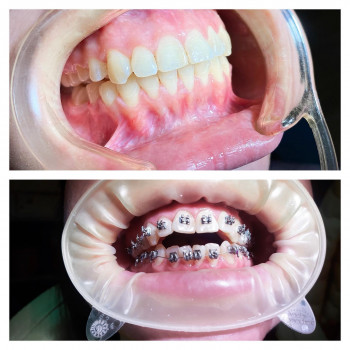 Андрей Нагорный, Одесса Фото - 5