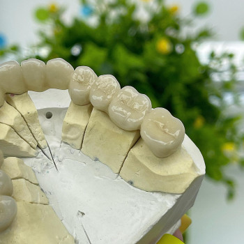 Ярослав Гараджа, Днепр Фото - 5