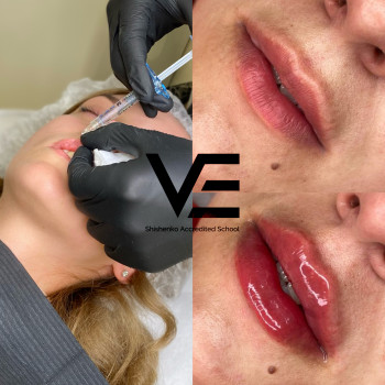 Контурная пластика
                    Салон красоты Studio Shishenko Днепр