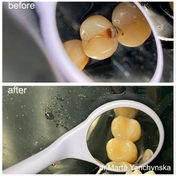 Марта Янчинська, Львов Фото - 5