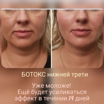 Наталия Нероли, Одеса Фото - 16