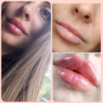 Наталия Нероли, Одеса Фото - 18