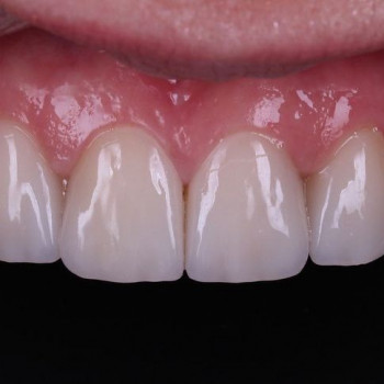 Александр Глазунов, Кривой Рог Фото - 5