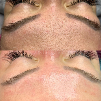 Наталья Окуловская, Київ Фото - 13