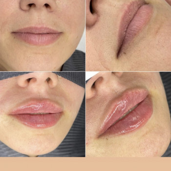 Ирина Лапань, Киев Фото - 2