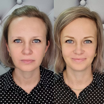 Брови после процедуры