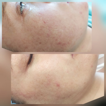 Юлия Злочевская, Белая Церковь Фото - 27