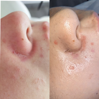 Юлия Злочевская, Белая Церковь Фото - 29