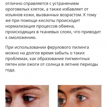 Ірина Литвінова, Херсон Фото - 37