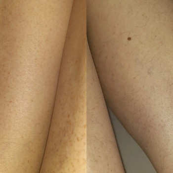 Анастасия Петрухнова, Полтава Фото - 5