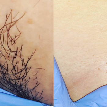 Анастасия Петрухнова, Полтава Фото - 6