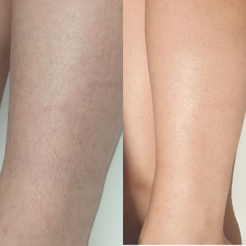 Анастасия Петрухнова, Полтава Фото - 7