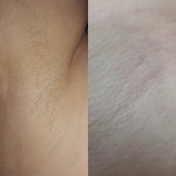 Анастасия Петрухнова, Полтава Фото - 8