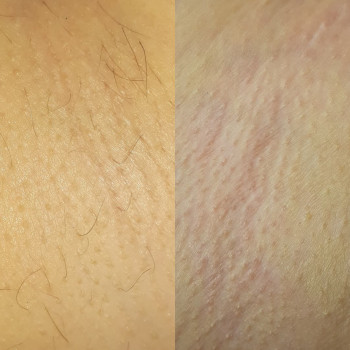 Анастасия Петрухнова, Полтава Фото - 15