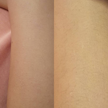 Анастасия Петрухнова, Полтава Фото - 17