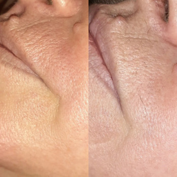 Анастасия Петрухнова, Полтава Фото - 20